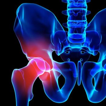hip pain